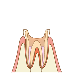 薬剤で洗浄・消毒していきます。