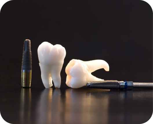 当院のインプラント治療